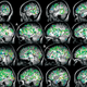 Illustration for article titled This Is What Your Brain Looks Like When You Masturbate